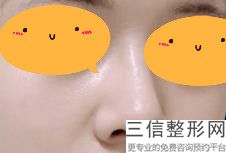 2022年上海达拉斯综合隆鼻整形整容医院榜单！上海市第十人民医院整形美容科是你没看过的版本
