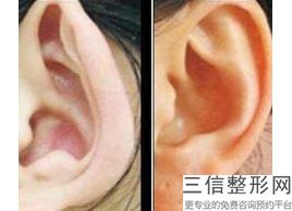 2022年上海大耳缩小术整容整形医院排行榜！上海伊莱美医疗美容医院医美公立私立汇总