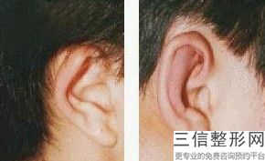 2022年上海大耳缩小整容医院前三名！上海皮肤病医院医学美容科2022美容价格表在线查询