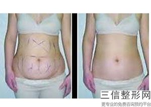 2022年上海大腿毛整形医院选择？上海鹏爱医疗美容门诊部2022价格表清单透明！