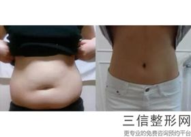2022年上海大腿脱毛整形医院前三名！上海科发源植发公立口碑都不错_附价格查询