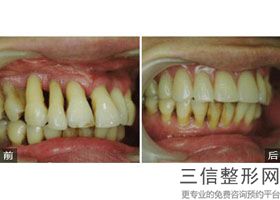 2022年上海地包天牙齿矫正整形医院哪家好？上海闵行中医医院驰名中外