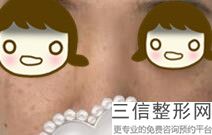 2022年上海垫鼻梁整形医院排行榜！上海玫瑰整形美容医院等领衔三甲