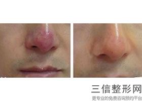 2022年上海垫鼻子整形医院评价！上海美赋医疗美容门诊部口碑领衔_还有价格费用爆出