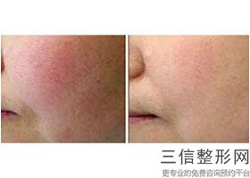 2022年上海电波拉皮整形医院！上海光博士医疗美容门诊部名扬四海