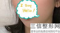 2022年上海嘟嘟唇丰唇整形医院榜单前三！上海韩镜医疗美容医院含价格一览表