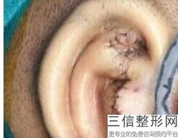 2022年上海耳畸形再造医院怎么选择？上海赛美瑞医疗美容门诊部出类拔萃