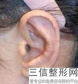 2022年上海耳廓畸形矫正整容医院前三名！上海复丽医疗美容门诊部看排名榜中公私立医院相互比拼！
