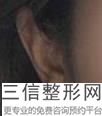 2022年上海耳廓较大缺损修复美容整形医院哪家好？上海美尔雅医疗美容实力超强