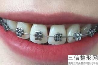2022年上海仿真纹眉医院排名前三位!上海第九人民医院口腔科锁定前三