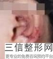 2022年上海副耳美容医院前三！上海东方医院整形外科均有公立整形上榜