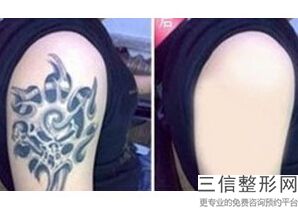2022年上海腹部抽脂整形医院哪里有？上海皮肤病医院医学美容科等口碑实力、价格表