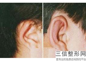 2022年上海附耳切除整形医院选择？上海星采医疗美容门诊部入围前三甲~名次查询