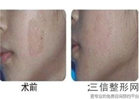 2022年上海割包皮整形医院哪里有？上海百达丽医疗美容门诊部名扬四海