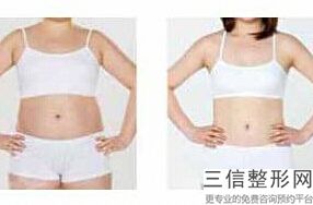 2022年上海硅胶丰胸整容医院排名！上海美之源整形外科医院看排名榜中公私立医院相互比拼！