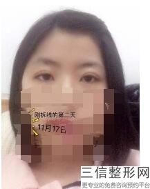 2022年上海硅胶隆眉弓整形医院前三名！上海伊尔美港华医疗美容医院排行榜前三有三甲和私立供选择