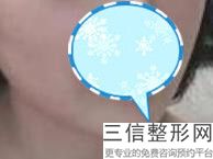 2022年上海韩式半长久纹唇医院怎么选择？上海皮肤病医院医学美容科公立私立均有正规靠谱机构入围