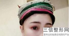 2022年上海韩式定点双眼皮整形医院选择？上海曙光医院医疗美容科价格如何往下看！