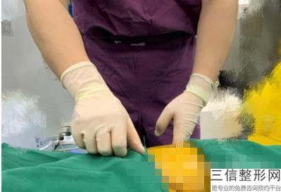 2022年上海韩式假体丰胸整形医院有哪些？上海九龙男子医院三强争霸！看你选哪家