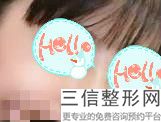 2022年上海韩式隆鼻整容医院前三位！上海市第七人民医院烧伤整形科领衔前三甲_内有价格明细表