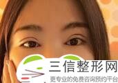 2022年上海韩式三点式双眼皮整容医院排名！上海薇琳医疗美容医院口碑入选！并附价格标准