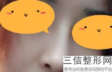 2022年上海朝天鼻整形医院如何选择?上海医颜医疗美容门诊部口碑良好