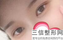 2022年上海韩式无痕翘睫双眼皮整形美容医院排名！上海瑞金医院整形外科高居榜首
