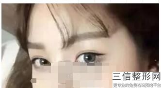 2022年上海韩式无痕双眼皮医院排名前三位！上海丽质医疗美容门诊部口碑领衔_还有价格费用爆出
