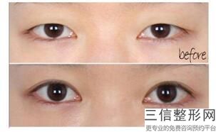 2022年上海黑眼圈去除整形医院评价！上海雅圣口腔门诊部名扬四海