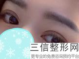 2022年上海黑眼圈修整术整形医院前三名！上海福曦口腔门诊整形价格表