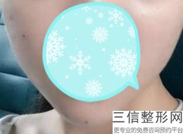 2022年上海厚唇改薄美容整形医院排名！上海美赋医疗美容门诊部口碑良好