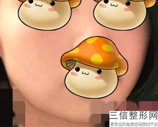 2022年上海厚唇矫正医院排名前三位！上海九龙男子医院家喻户晓