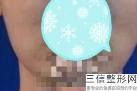 2022年上海厚嘴唇变薄整容医院前三位！上海锦晖医疗美容2022美容价格表在线查询