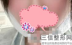 2022年上海厚嘴唇改薄整形医院榜单！上海丽质医疗美容门诊部公立私立均有正规靠谱机构入围
