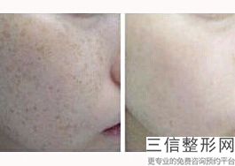 2022年上海激光皮肤美容整形医院有哪些?上海医颜医疗美容门诊部医美3强口碑技术点评!