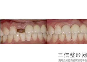 2022年上海激光祛痘整容医院前三名！上海福曦口腔门诊声威大震