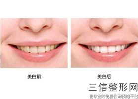 2022年上海激光去疤痕整容整形医院排行榜！上海恒愿口腔门诊部公立口碑都不错_附价格查询