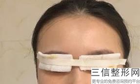 2022年上海激光去除黑眼圈整容整形医院排行榜！上海复美医疗美容门诊部医美5强实力口碑盘点，附价格