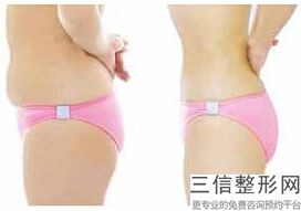 2022年上海激光脱小腿毛整容医院排名！上海瑞金医院整形外科分享排名前四口碑！