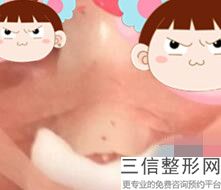 2022年上海矫正长鼻增生整容医院前三名！上海纽菲思医疗美容门诊部等实力入选~附价格