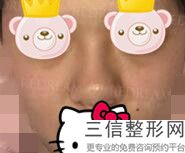 2022年上海矫正歪鼻子整容医院前三名！上海美仑医疗美容门诊部等上榜！附价格表！