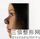 2022年上海胶原蛋白垫下巴医院怎么选择？上海一美整形外科医院驰名中外
