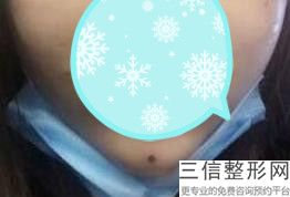 2022年上海胶原蛋白丰唇整形美容院榜单！上海联美致美医疗美容门诊均有公立整形上榜