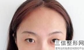 2022年上海胶原蛋白隆眉弓整形医院!上海韩镜医疗美容医院一起来看看哪些牛?