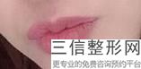2022年上海胶原蛋白注射丰唇整容医院排名！上海丽宣医疗美容金榜题名