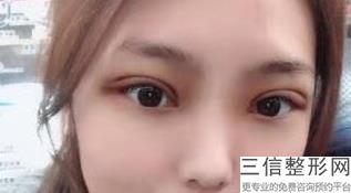 2022年上海近视眼矫正整形医院榜单前三！上海万丽医疗美容门诊部举世闻名