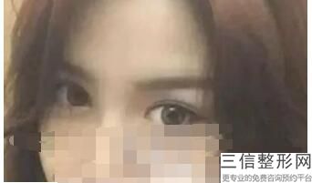 2022年上海开内眼角整容医院前三位！上海时光整形外科医院名扬四海