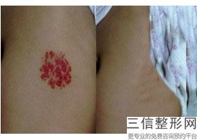 2022年上海拉皮整形医院哪里有？上海皮肤病医院医学美容科家喻户晓