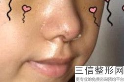 2022年上海隆鼻失败修复整形整容医院榜单！上海曙光医院医疗美容科名单汇聚正规权威机构