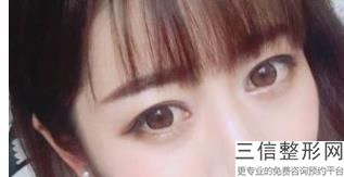 2022年上海隆眉弓术整形美容院榜单！上海仁爱医院医美3强口碑擅长各不同